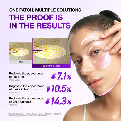 [Anua] Retinol Berry Revitalizing Eye Patch for Wrinkle and Dark Circles(60Ea), 8Hour Plumping Effect in 10 Minutes, Fuller Looking & Lifted Skin, Hyal-Plumping Effect, Brightens Undereye by Antioxidant Berry Extracts, Relieves Puffiness with Caffeine